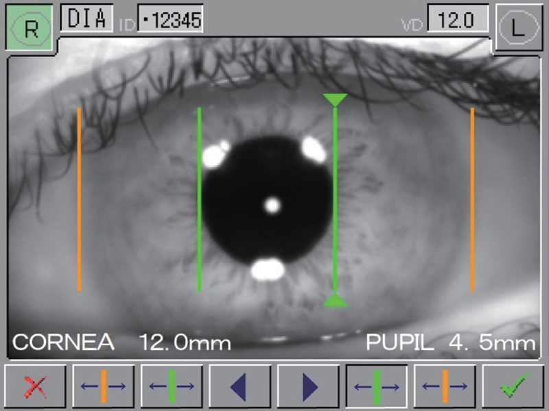 ARKM-150 cornea measurement