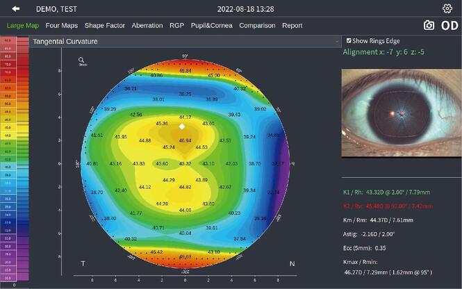 DEA-520 corneal topoghraphy