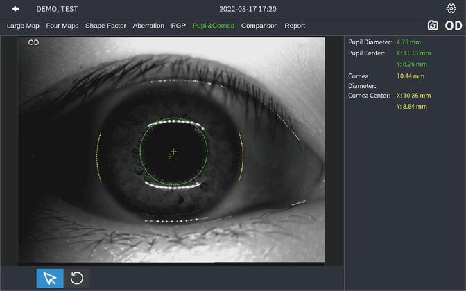 DEA-520 pupil and corneal diameter