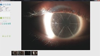 Takagi EyeCam Image Capture