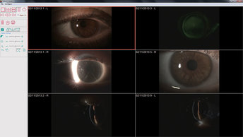 Takagi EyeCam Image Comparison
